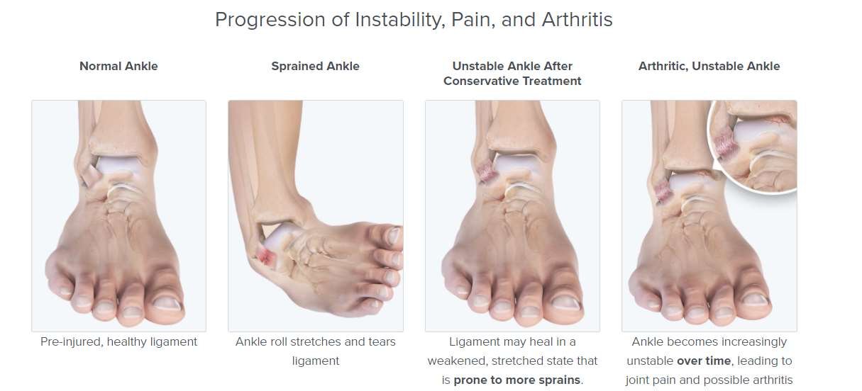 Foot & Ankle Pain Centre for Orthopaedics