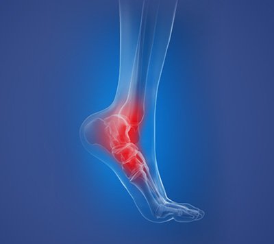 Centre for Foot and Ankle Surgery - Centre for Orthopaedics